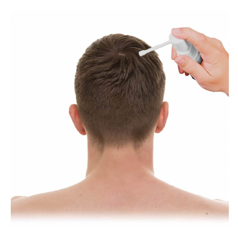 3 Minoxidil Kirkland Espuma 5% Foam Hair Regrowth Biotina 10000 Mcg